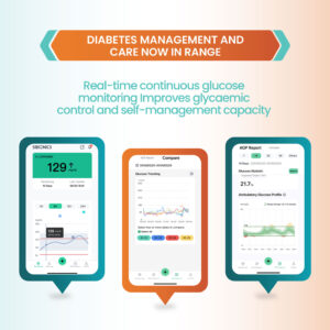 SIBIONICS CGM